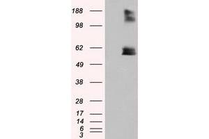 Image no. 2 for anti-Lipase, Endothelial (LIPG) antibody (ABIN1499175) (LIPG antibody)