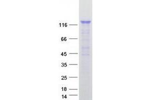 Validation with Western Blot (RALGDS Protein (Transcript Variant 1) (Myc-DYKDDDDK Tag))