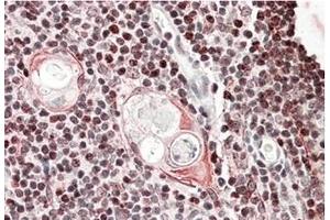 AP23696PU-N SATB1 Antibody staining of of paraffin embedded Human Thymus at 3. (SATB1 antibody  (Internal Region))