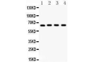 Anti- NF-kB p65 Picoband antibody, Western blotting All lanes: Anti NF-kB p65  at 0. (NF-kB p65 antibody  (AA 291-479))