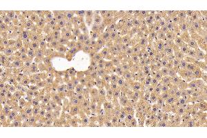 Detection of NNMT in Mouse Liver Tissue using Polyclonal Antibody to Nicotinamide-N-Methyltransferase (NNMT) (NNMT antibody  (AA 1-264))