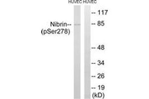 Western blot analysis of extracts from HuvEc cells treated with Forskolin 40nM 30', using Nibrin (Phospho-Ser278) Antibody. (Nibrin antibody  (pSer278))