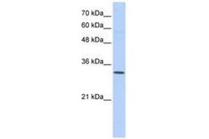 Image no. 1 for anti-Sideroflexin 1 (SFXN1) (N-Term) antibody (ABIN6741065)