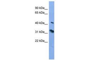 Image no. 1 for anti-Rhodopsin (RHO) (C-Term) antibody (ABIN6746706)