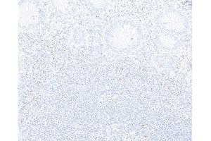 Immunohistochemistry (IHC) image for anti-Cytotoxic T-Lymphocyte-Associated Protein 4 (CTLA4) (C-Term) antibody (ABIN7795650) (Recombinant CTLA4 antibody  (C-Term))