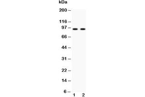 Western blot testing of Cadherin 17 antibody and Lane 1:  HeLa;  2: SW620 lysate (LI Cadherin antibody  (AA 686-699))