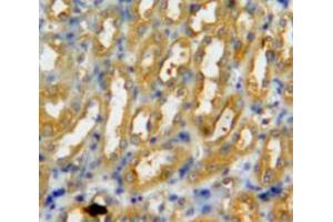 Used in DAB staining on fromalin fixed paraffin-embedded kidney tissue (PADI3 antibody  (AA 1-300))