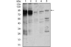 Western blot analysis using STAT5A mouse mAb against K562 (1), MOLT4 (2), HeLa (3), Jurkat (4), and A431 (5) cell lysate.