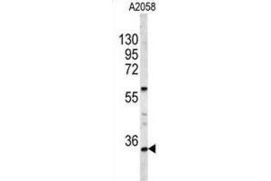 Western Blotting (WB) image for anti-Homeobox A9 (HOXA9) antibody (ABIN3004038) (HOXA9 antibody)