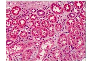 Human Kidney: Formalin-Fixed, Paraffin-Embedded (FFPE) (LGI3 antibody  (Center))