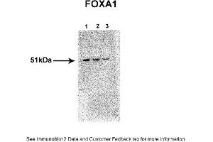 Sample Type: 1. (FOXA1 antibody  (N-Term))