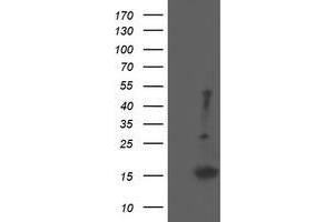 Image no. 3 for anti-Eukaryotic Translation Initiation Factor 5A2 (EIF5A2) antibody (ABIN1497997) (EIF5A2 antibody)