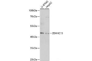 Western blot analysis of extracts of various cell lines using ZDHHC15 Polyclonal Antibody at dilution of 1:1000. (ZDHHC15 antibody)