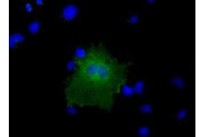 Anti-CBWD1 mouse monoclonal antibody (ABIN2452883) immunofluorescent staining of COS7 cells transiently transfected by pCMV6-ENTRY CBWD1 (RC222790). (CBWD1 antibody)