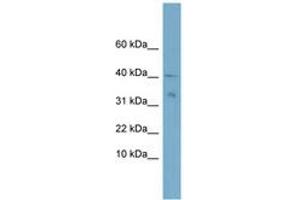 Image no. 1 for anti-NADH Dehydrogenase (Ubiquinone) Flavoprotein 3, 10kDa (NDUFV3) (C-Term) antibody (ABIN6743390) (NDUFV3 antibody  (C-Term))