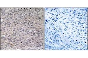 Immunohistochemistry analysis of paraffin-embedded human thyroid gland, using IREB1 (Phospho-Ser711) Antibody. (Aconitase 1 antibody  (pSer711))