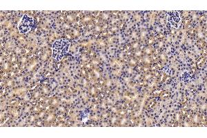 Detection of NNMT in Mouse Kidney Tissue using Polyclonal Antibody to Nicotinamide-N-Methyltransferase (NNMT) (NNMT antibody  (AA 1-264))