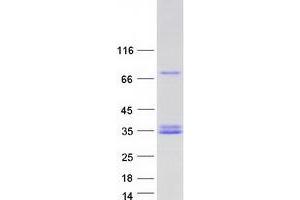 Validation with Western Blot (CFHR2 Protein (Myc-DYKDDDDK Tag))