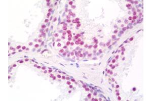 Anti-THRAP3 / TRAP150 antibody IHC staining of human prostate. (THRAP3 antibody  (C-Term))