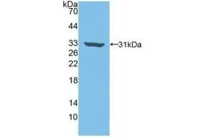 Detection of Recombinant Rock2, Human using Polyclonal Antibody to Rho Associated Coiled Coil Containing Protein Kinase 2 (Rock2) (ROCK2 antibody  (AA 904-1140))