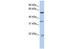Image no. 1 for anti-Dihydropyrimidinase-Like 2 (DPYSL2) (AA 432-481) antibody (ABIN6743605) (DPYSL2 antibody  (AA 432-481))