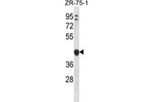 YIPF1 Antibody (N-term) western blot analysis in ZR-75-1 cell line lysates (35 µg/lane).