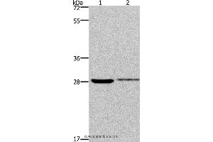 Western blot analysis of 231 and Hela cell, using CDK1 Polyclonal Antibody at dilution of 1:300 (CDK1 antibody)