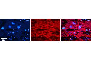 Rabbit Anti-MAOB Antibody   Formalin Fixed Paraffin Embedded Tissue: Human heart Tissue Observed Staining: Cytoplasmic Primary Antibody Concentration: 1:100 Other Working Concentrations: N/A Secondary Antibody: Donkey anti-Rabbit-Cy3 Secondary Antibody Concentration: 1:200 Magnification: 20X Exposure Time: 0. (Monoamine Oxidase B antibody  (C-Term))