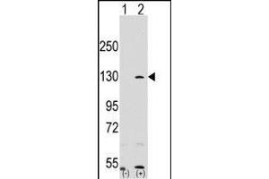 Western blot analysis of RP1 (arrow) using rabbit polyclonal RP1 Antibody (N-term) (ABIN390353 and ABIN2840765). (PARP1 antibody  (N-Term))