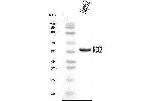 Western blot analysis of RCC2 using anti-RCC2 antibody (ABIN7601154).