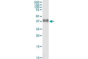 Immunoprecipitation of PHOX2A transfected lysate using anti-PHOX2A MaxPab rabbit polyclonal antibody and Protein A Magnetic Bead , and immunoblotted with . (PHOX2A antibody  (AA 1-284))