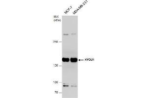 WB Image HYOU1 antibody detects HYOU1 protein by western blot analysis. (HYOU1 antibody  (C-Term))