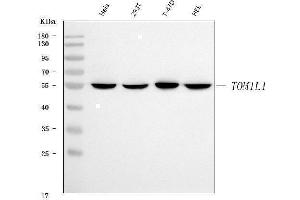 Western blot analysis of TOM1L1 using anti-TOM1L1 antibody (ABIN7602631).