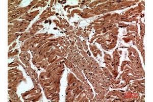 Immunohistochemistry (IHC) analysis of paraffin-embedded Human Heart, antibody was diluted at 1:100.