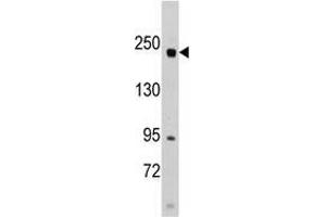 Western blot analysis of anti-RICTOR Pab in SK-BR-3 cell line lysates (35 µg/lane). (RICTOR antibody  (N-Term))