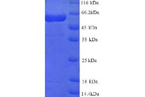 SDS-PAGE (SDS) image for Multiple Inositol-Polyphosphate Phosphatase 1 (MINPP1) (AA 31-487) protein (His tag) (ABIN5714516) (MINPP1 Protein (AA 31-487) (His tag))