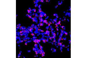 Immunofluorescence of paraffin embedded rat lung using P4H (ABIN7074215) at dilution of 1:700 (400x lens) (HIF Prolyl Hydroxylase antibody)