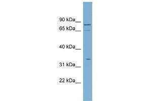 WB Suggested Anti-SLC5A9 Antibody Titration:  0.