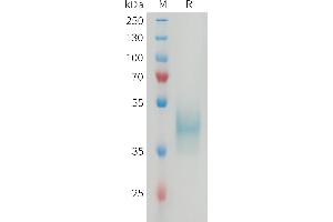 SDS-PAGE (SDS) image for CD24 Molecule (CD24) (AA 27-52) protein (Fc Tag) (ABIN7538165)