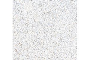 Immunohistochemistry (IHC) image for anti-Myocyte Enhancer Factor 2C (MEF2C) (AA 425-475) antibody (ABIN7795747) (Recombinant MEF2C antibody  (AA 425-475))