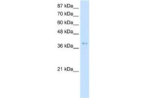 WB Suggested Anti-PRMT1 Antibody Titration:  5. (PRMT1 antibody  (Middle Region))