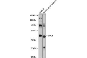 Western blot analysis of extracts of various cell lines, using STK25 antibody (ABIN6132842, ABIN6148604, ABIN6148605 and ABIN6225078) at 1:1000 dilution.