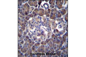 MLM Antibody (C-term) (ABIN6242125 and ABIN6577331) immunohistochemistry analysis in formalin fixed and paraffin embedded human pancreas tissue followed by peroxidase conjugation of the secondary antibody and DAB staining. (Cutaneous Malignant Melanoma/dysplastic Nevus antibody  (C-Term))
