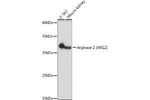 Western blot analysis of extracts of various cell lines, using Arginase 2  antibody (ABIN6131236, ABIN6137078, ABIN6137079 and ABIN6221969) at 1:1000 dilution. (ARG2 antibody  (AA 1-354))