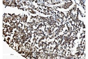 IHC analysis of DDX1 using anti-DDX1 antibody (ABIN7602051). (DDX1 antibody  (AA 562-740))