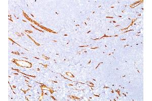 Formalin-fixed, paraffin-embedded human tonsil stained with CD34 Mouse Monoclonal Antibody (QBEnd/10). (CD34 antibody)
