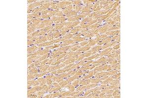 Immunohistochemistry of paraffin embedded rat heart using MYL6 (ABIN7074734) at dilution of 1:650 (400x lens) (MYL6 antibody)