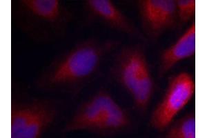 Immunofluorescence staining of methanol-fixed Hela cells using Phospho-MARCKS-S162 antibody. (MARCKS antibody  (pSer162))