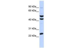 Image no. 1 for anti-Zinc Finger Protein 200 (ZNF200) (AA 324-373) antibody (ABIN6742764)