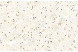 Immunohistochemistry (IHC) image for anti-Leucine Rich Repeat and Ig Domain Containing 1 (LINGO1) (AA 575-603), (C-Term) antibody (ABIN651289)
